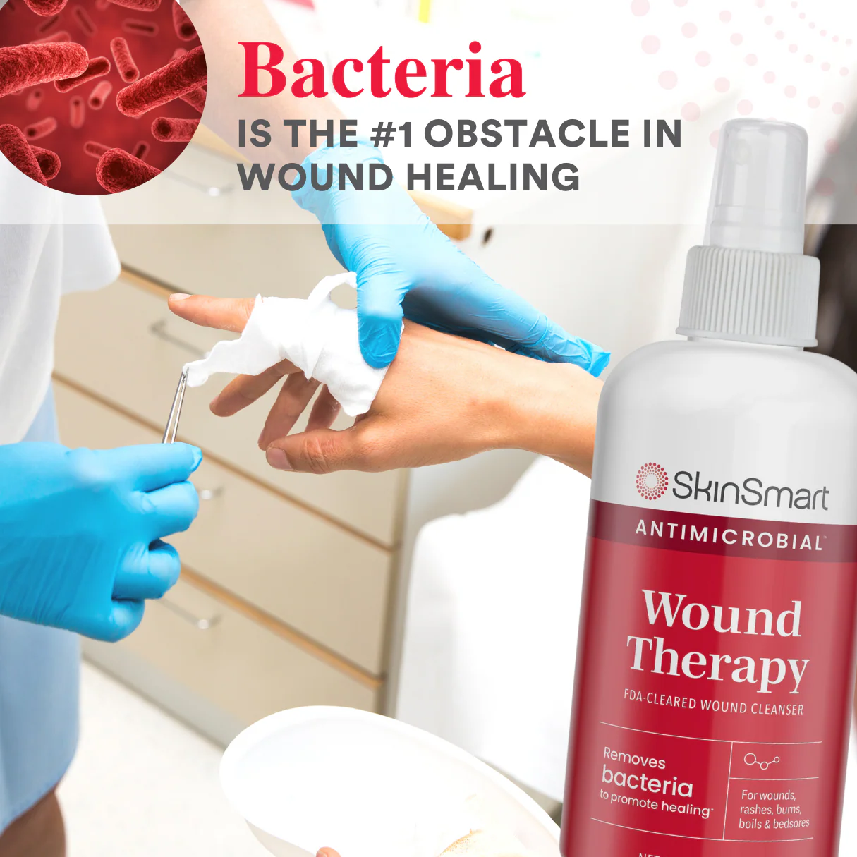 SkinSmart Antimicrobial Wound Therapy - Image 6