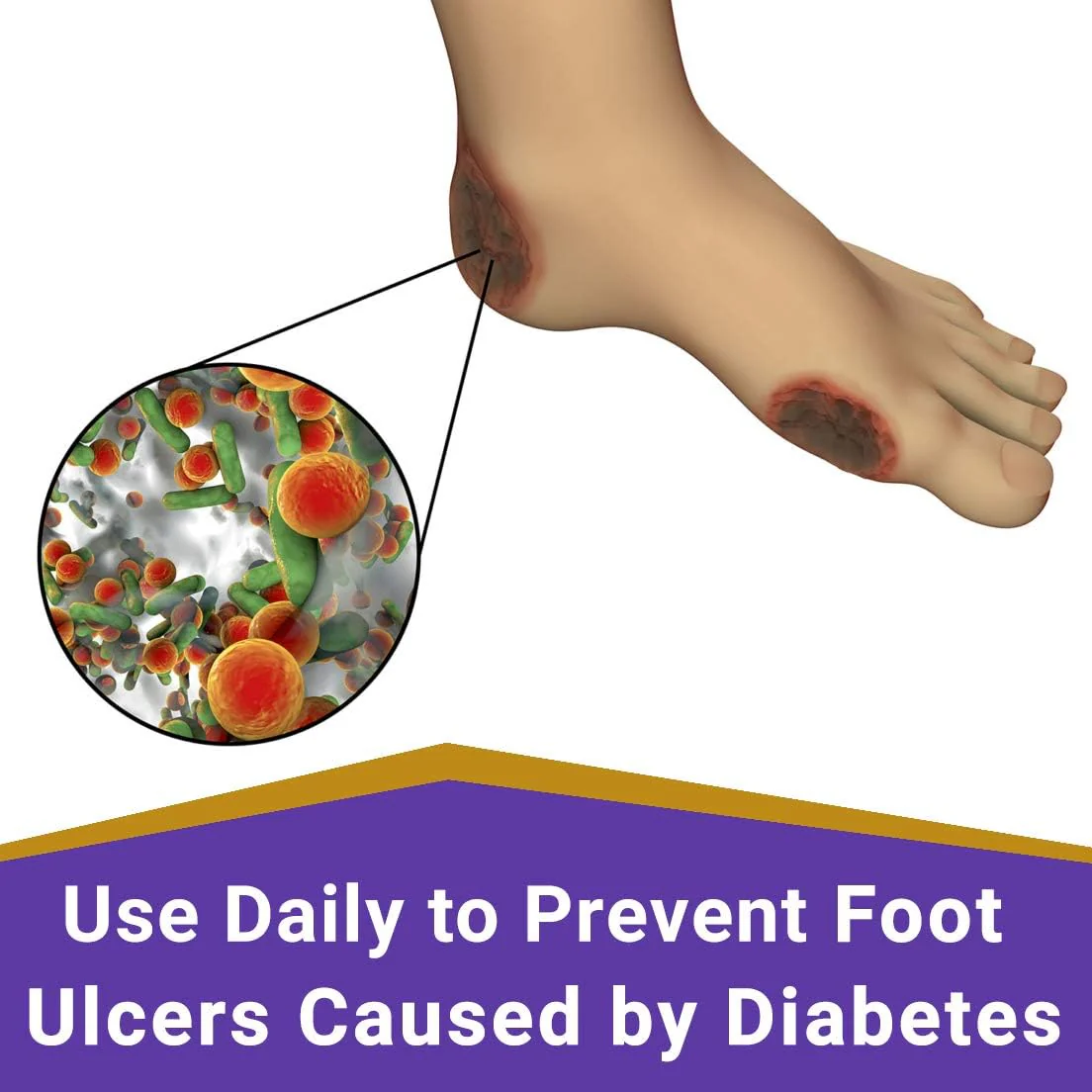 SkinSmart Daily Foot Cleanser for At-Risk Feet - Image 3